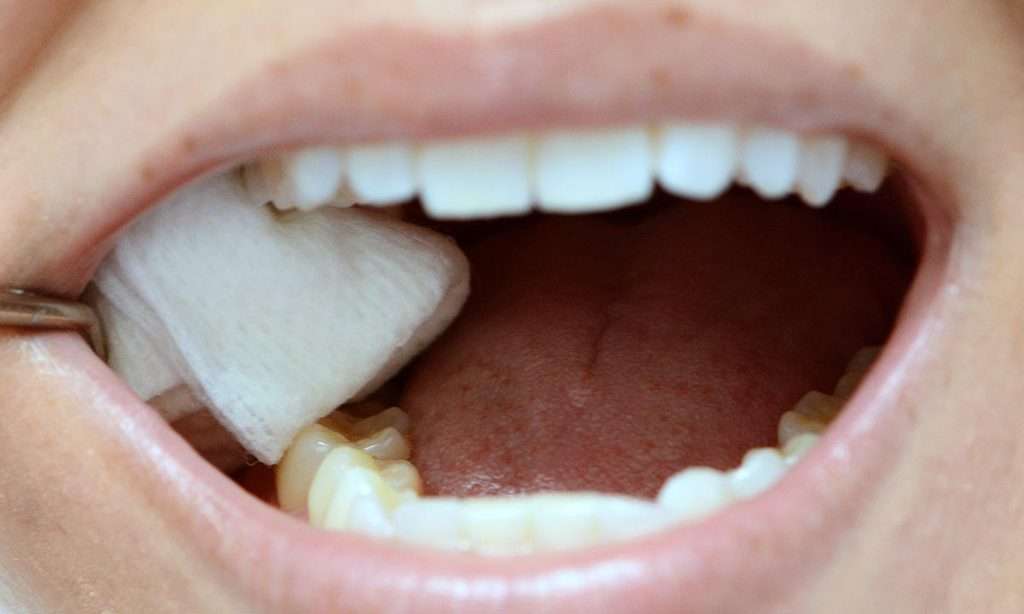 Biting on gauze after tooth extraction