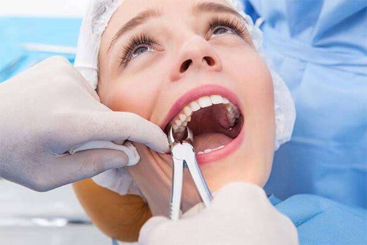 Tooth extraction aftercare